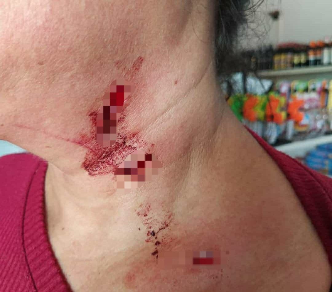 Imagem da notícia: Comerciante é golpeada por arma branca no pescoço durante tentativa de assalto registrada em Guaraí