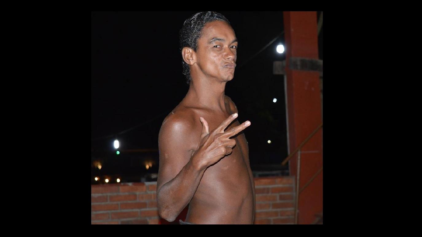 Muito conhecido em Guaraí, "Xexinha” morre vítima de complicações da diabetes