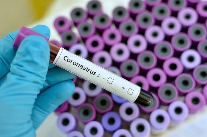 Número de casos suspeitos do coronavírus segue aumentando em Guaraí, agora são 25